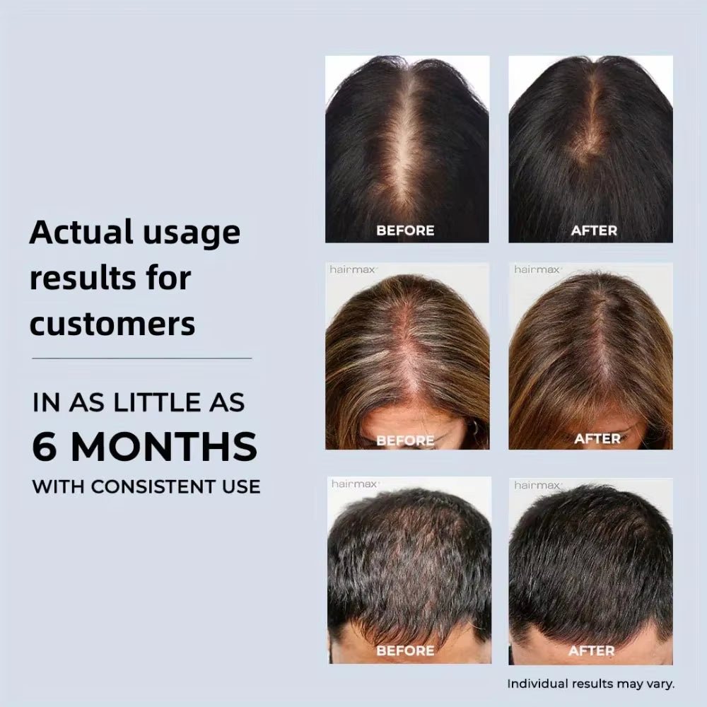 96 Lamp LED Laser Beads Therapy Promoting Hair Growth - Naved ProductsNew 96 Lamp Beads Laser Hair Growth Cap Red Light Therapy Hat Professional Cap for Greasy Scalp Hair Care Adjustable Rear Strap