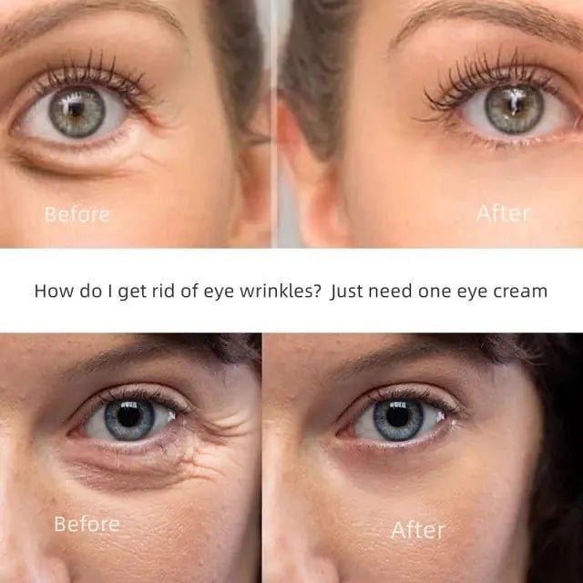 New Anti - Wrinkle Eye Cream - Watch Your Eyes Brighten! - Naved ProductsNew Anti - Wrinkle Eye Cream - Watch Your Eyes Brighten! - Naved Products