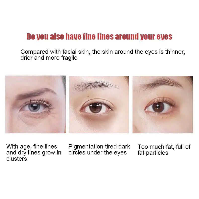 New Anti - Wrinkle Eye Cream - Watch Your Eyes Brighten! - Naved ProductsNew Anti - Wrinkle Eye Cream - Watch Your Eyes Brighten! - Naved Products