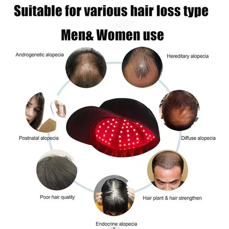 96 Lamp LED Laser Beads Therapy Promoting Hair Growth - Naved ProductsNew 96 Lamp Beads Laser Hair Growth Cap Red Light Therapy Hat Professional Cap for Greasy Scalp Hair Care Adjustable Rear Strap