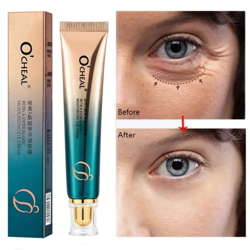 New Anti - Wrinkle Eye Cream - Watch Your Eyes Brighten! - Naved ProductsNew Anti - Wrinkle Eye Cream - Watch Your Eyes Brighten! - Naved Products