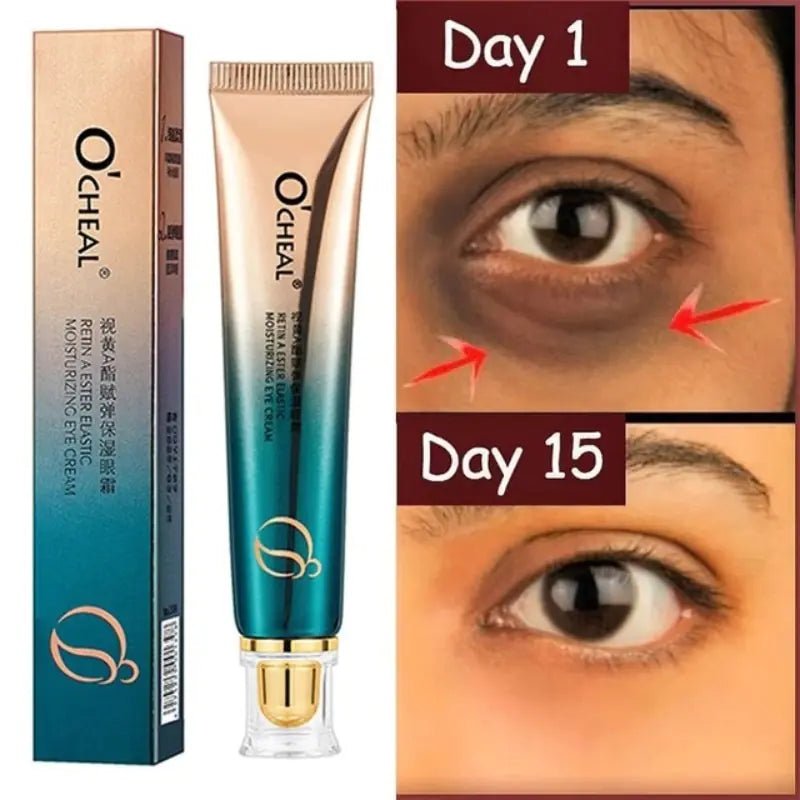 New Anti - Wrinkle Eye Cream - Watch Your Eyes Brighten! - Naved ProductsNew Anti - Wrinkle Eye Cream - Watch Your Eyes Brighten! - Naved Products